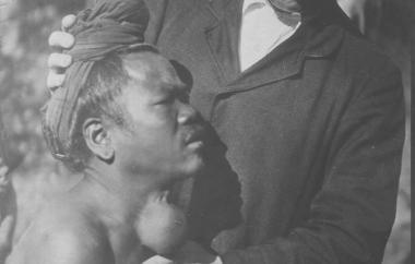 Dr. East examines a man with goiter